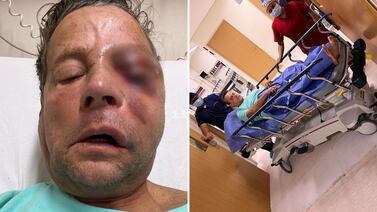 Alfredo Adame sale del hospital tras ser operado de un ojo