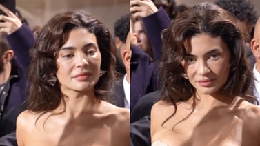 Kylie Jenner sorpende al lucir con arrugas a sus 26 años: "¿qué se hizo en la cara?", cuestionan