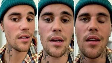 ¡Grave! Justin Bieber sufre de parálisis facial, por lo que canceló sus conciertos
