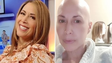 Marta Guzmán comparte su primera foto sin cabello tras luchar contra el cáncer de mama