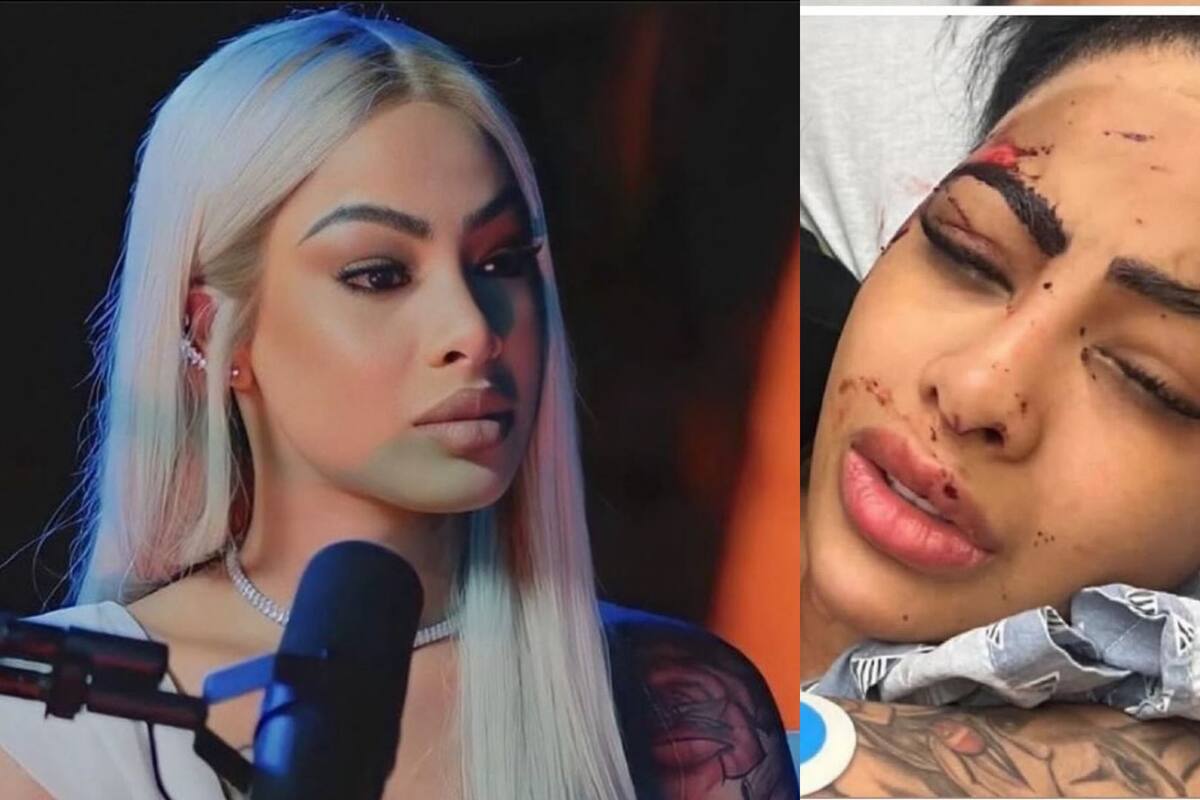 Yailin aclara situación tras filtrarse foto de ella con golpes en la cara: ¿fue el rapero 6ix9ine?
