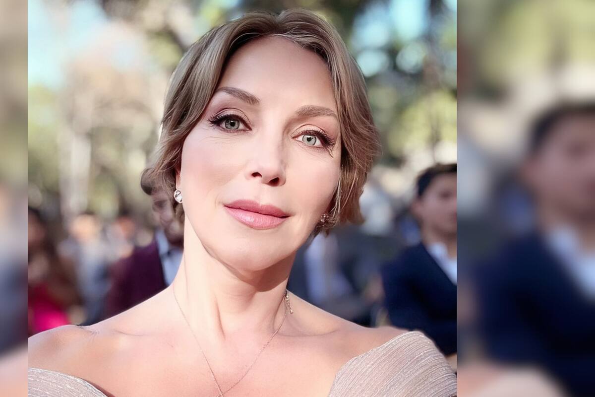 Laura Flores: este es el procedimiento estético por el que la actriz sufrió un microinfarto cerebral