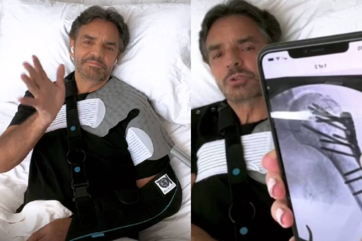 Eugenio Derbez reaparece y explica los verdaderos motivos de su accidente