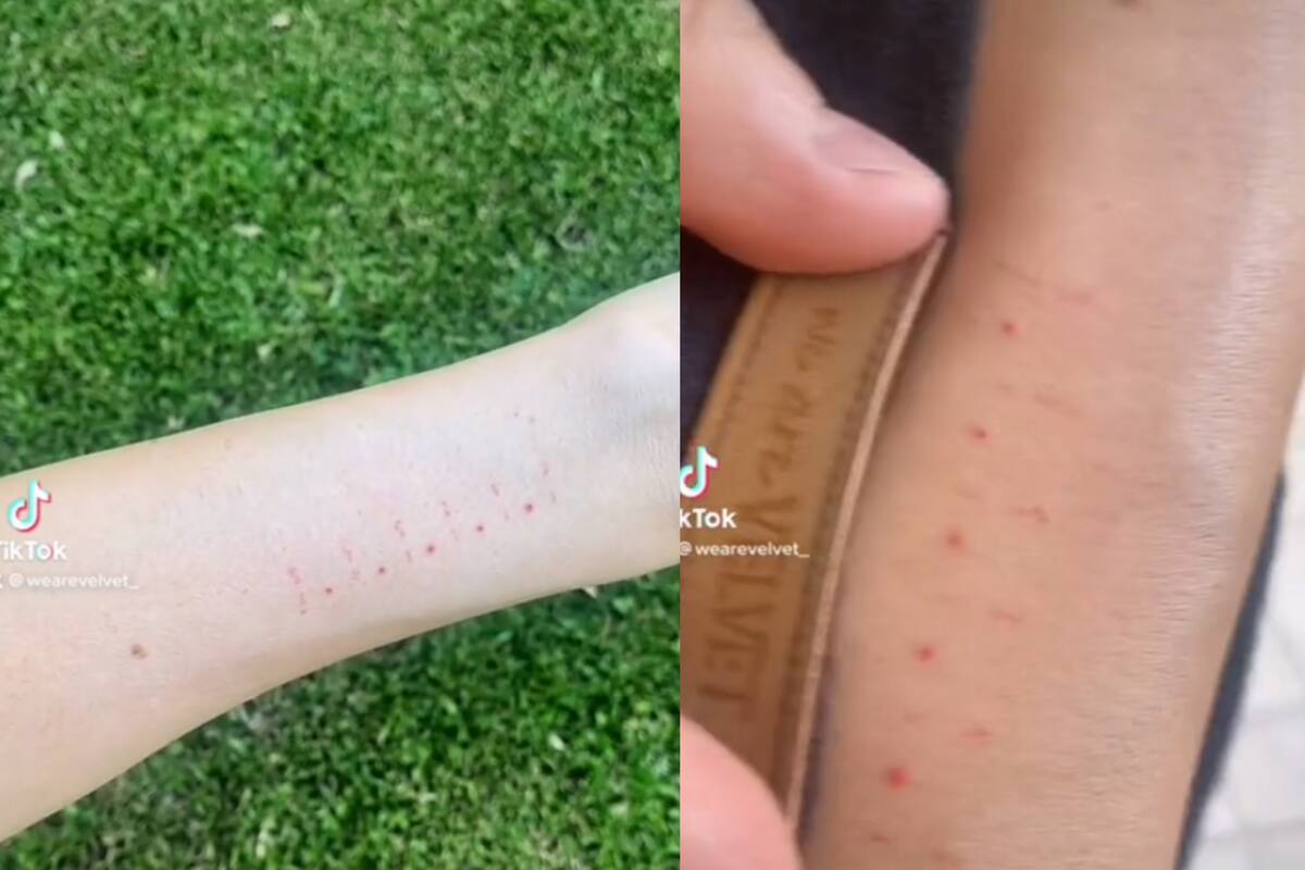 Joven que le encanta medir cosas se tatúo una regla y se viralizó en TikTok