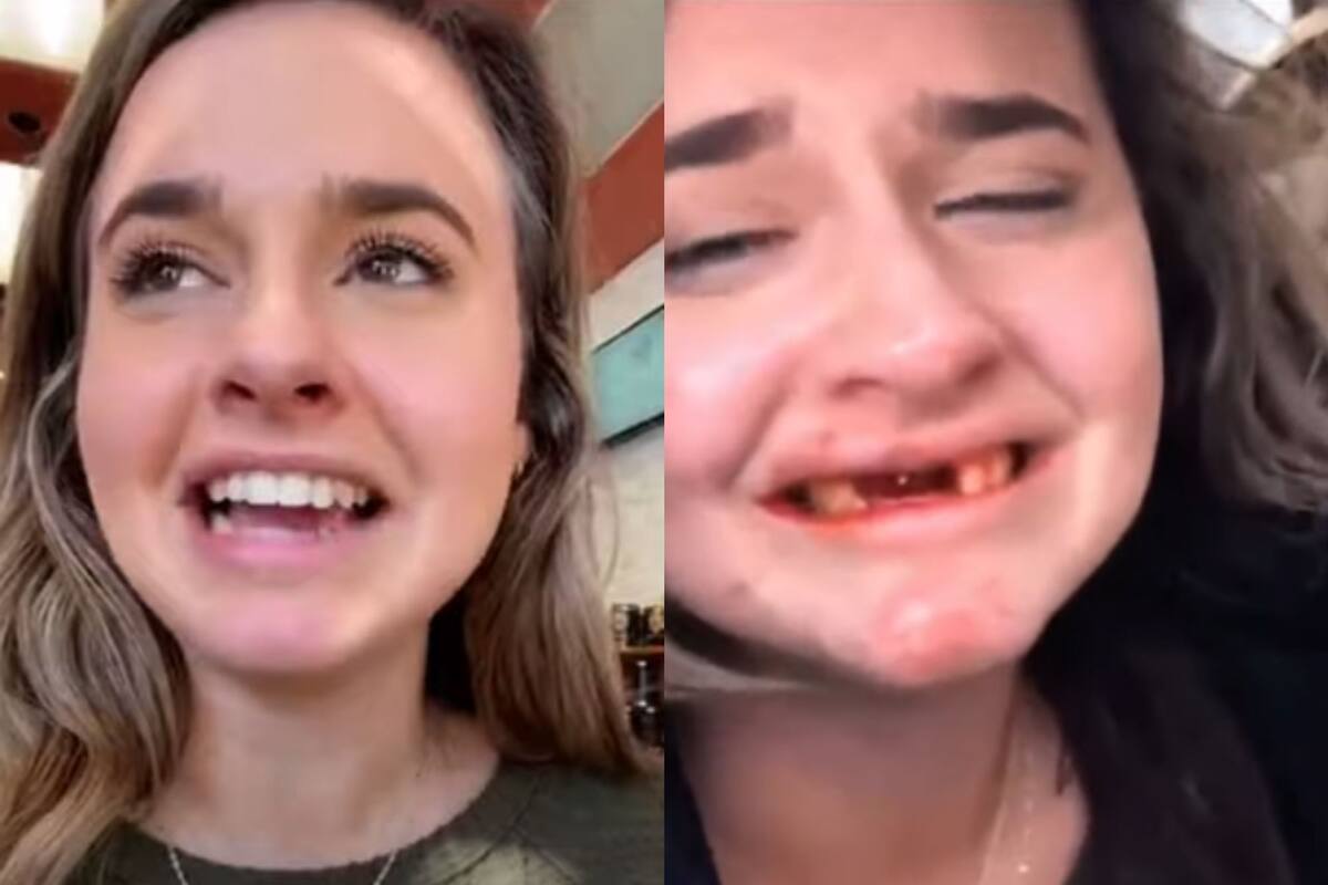Joven intenta hacer reto viral y se queda sin dientes
