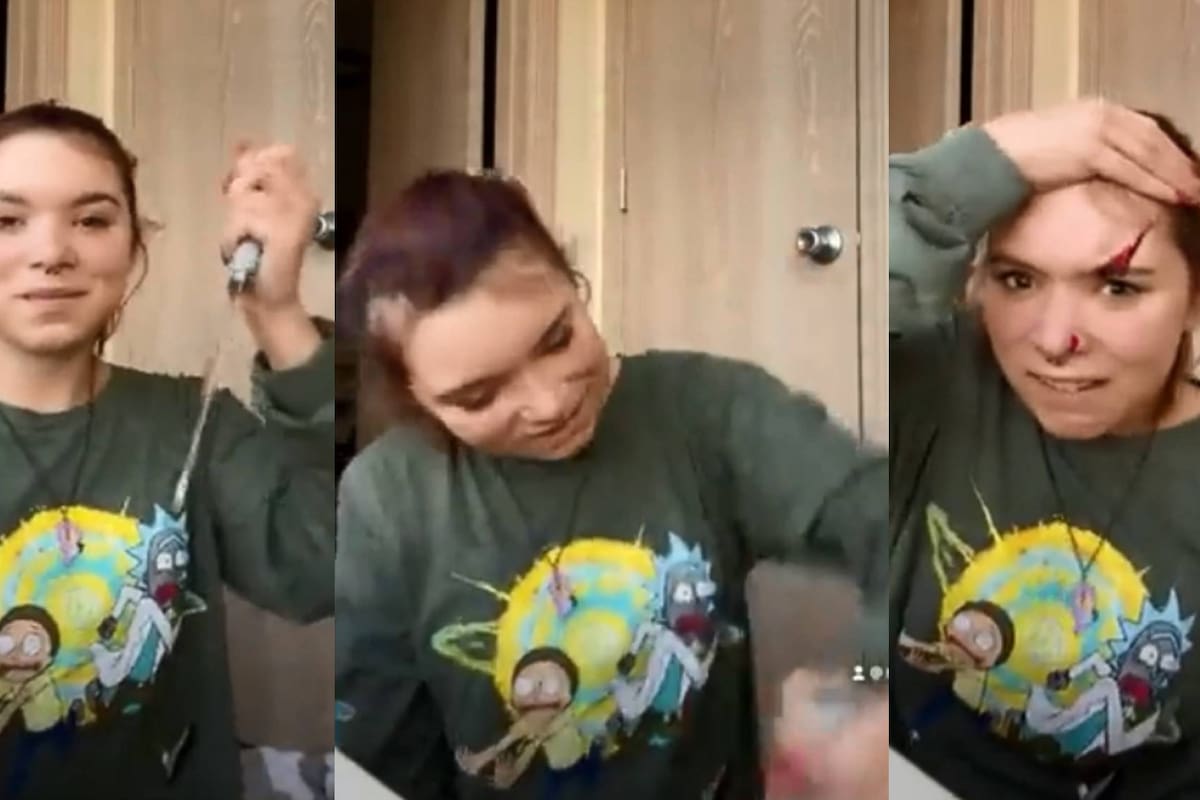 Por reto viral de TikToK, joven se corta la cara con cuchillo