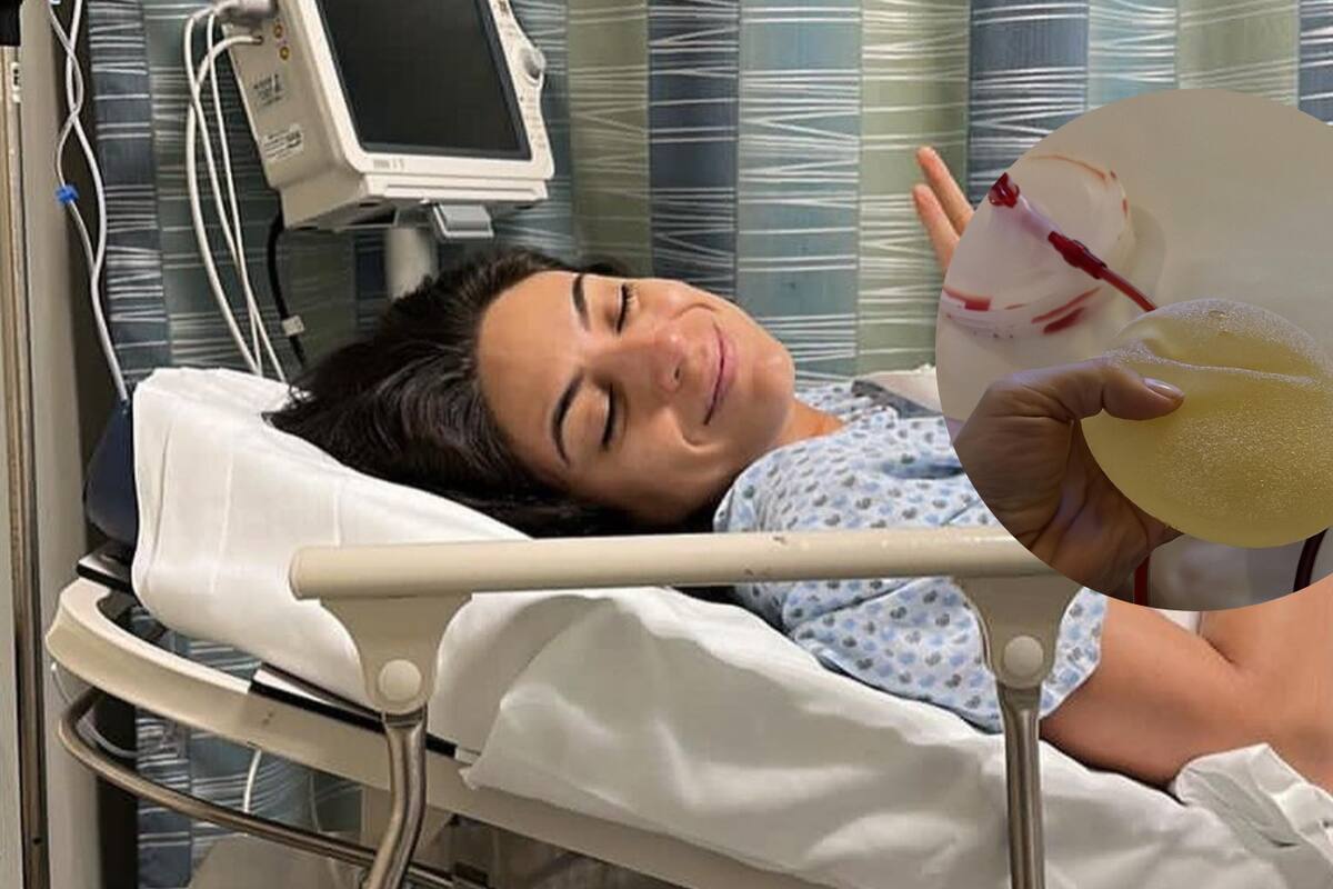 Ana Brenda se retira los implantes mamarios y comparte su proceso