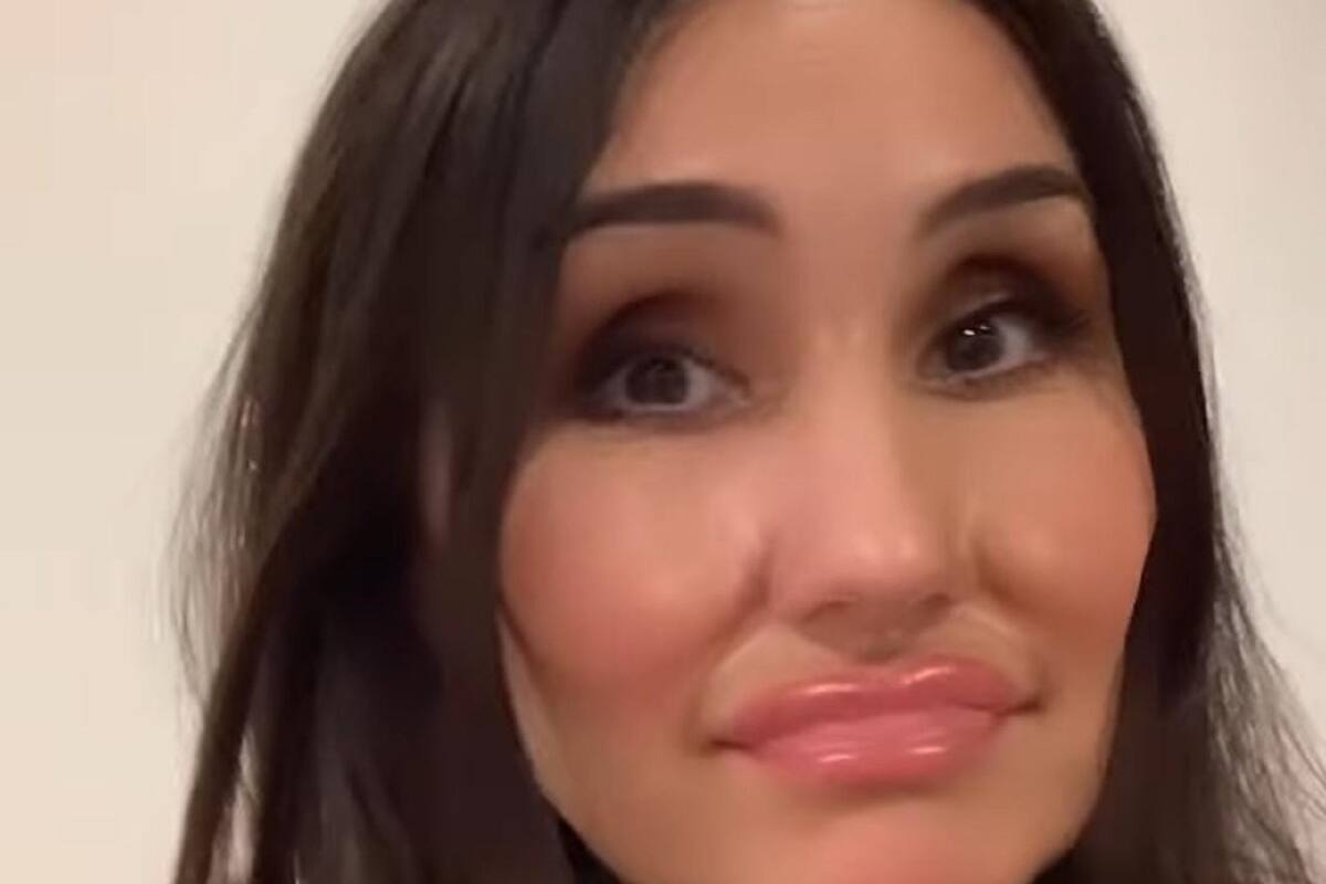 Dulce María muestra cómo se vería su rostro con exceso de botox