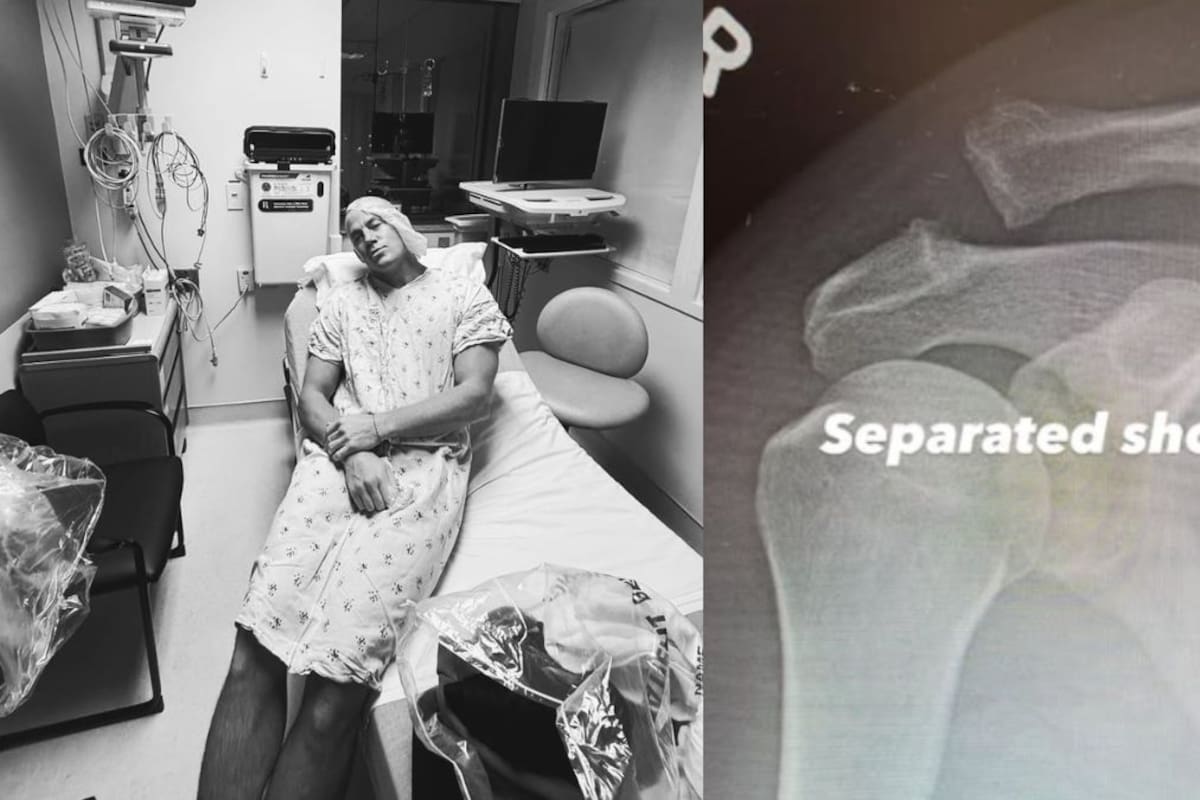 Channing Tatum confirma operación en el hombro tras sufrir una lesión seria y muestra radiografías desde el hospital
