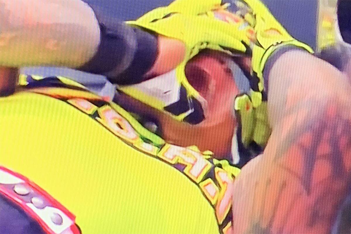 ¿Es verdad que Rey Mysterio perdió un ojo en un combate de la WWE?