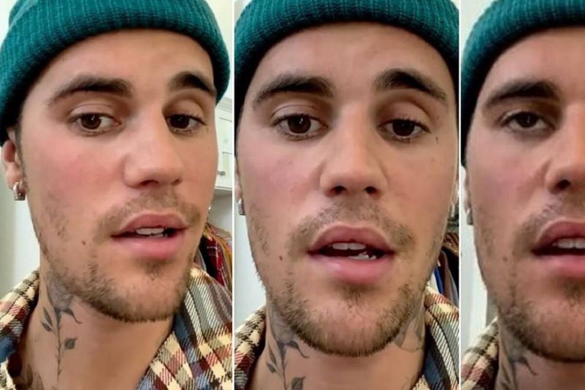 ¡Grave! Justin Bieber sufre de parálisis facial, por lo que canceló sus conciertos
