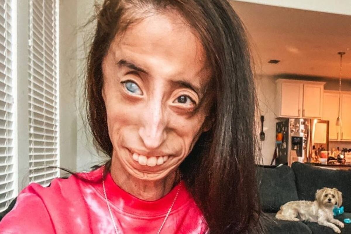 "Esta moda debe parar": Lizzie Velásquez pide que dejen de utilizar su foto para bromas en TikTok