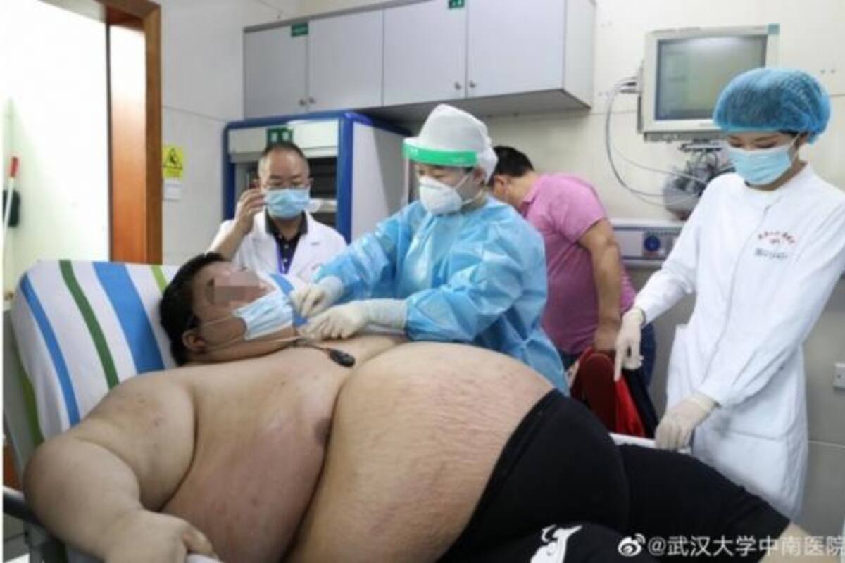 Joven sube más de 100 kilos durante la cuarentena en Wuhan, China