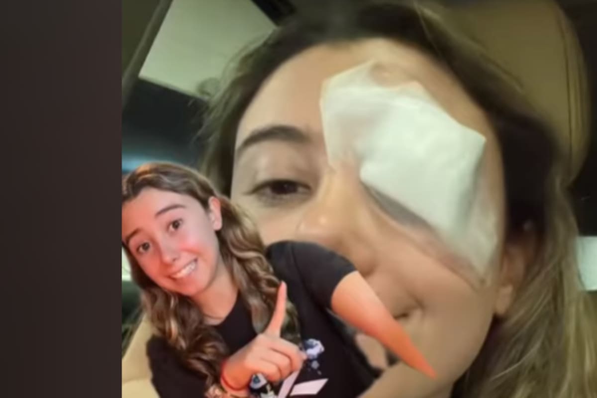 TikTok: Joven prueba consejo de belleza y termina en el hospital