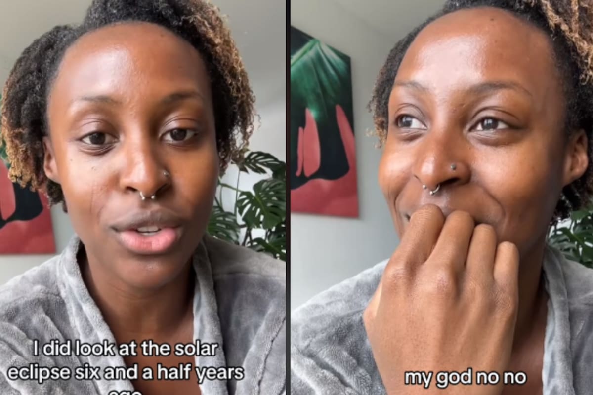 VIDEO: Tiktoker cuenta las consecuencias de haber visto el eclipse sin protección