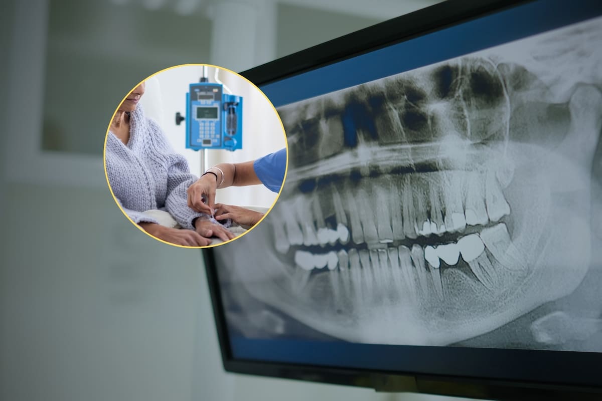 Expertos alertan que las bacterias orales podrían impactar en la aparición y avance del cáncer y otras enfermedades complejas