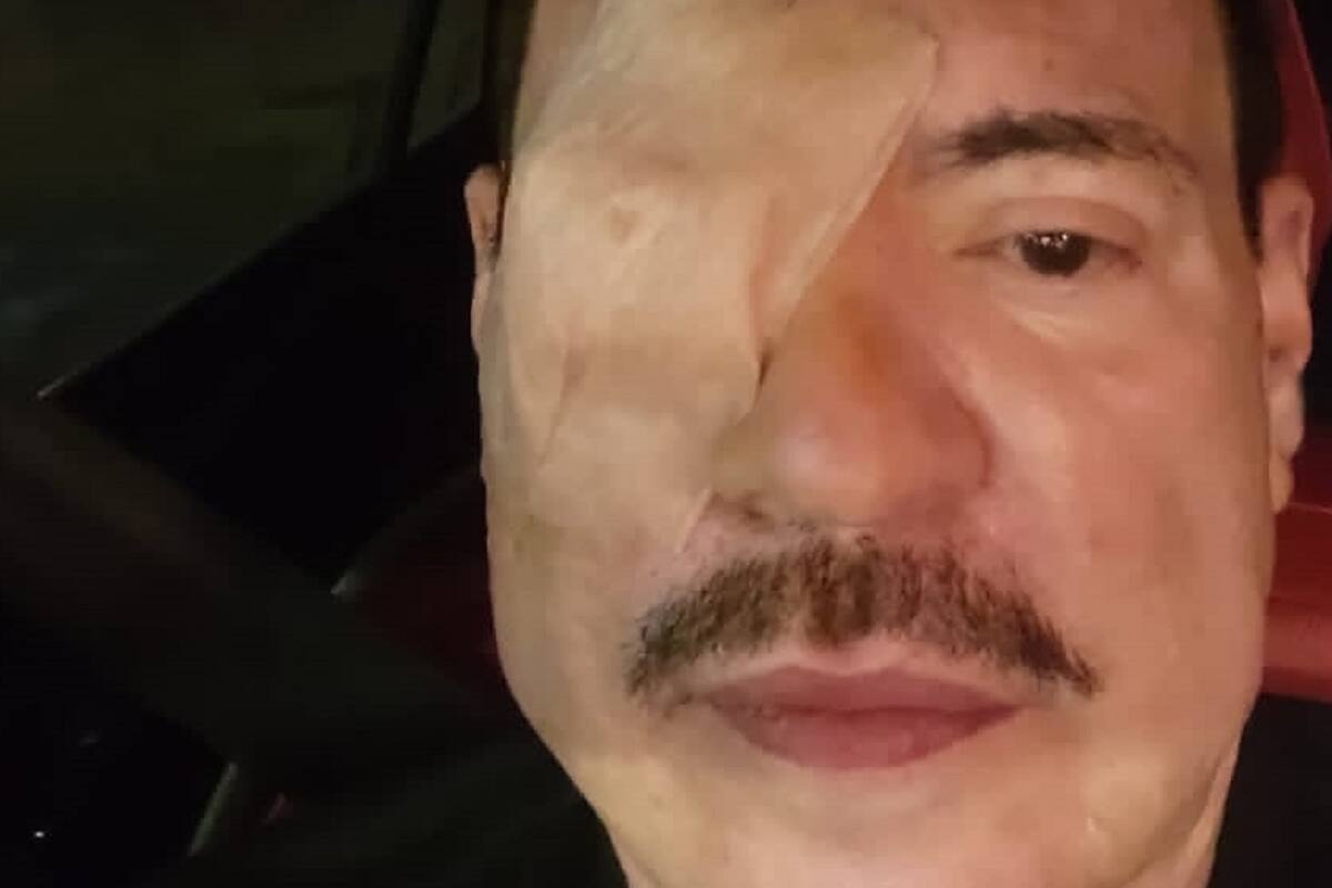 Operan de emergencia a Julio Preciado porque se quedó sin vista