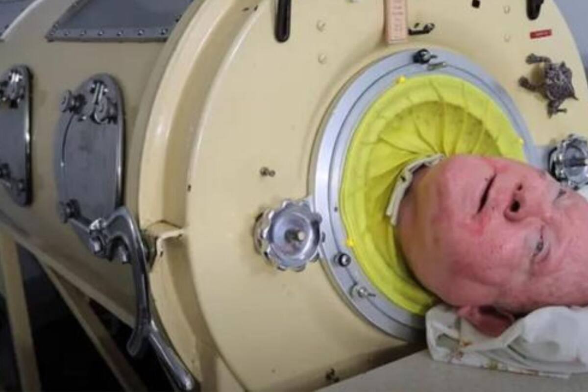 Fallece Paul Alexander, mejor conocido como el hombre con pulmón de acero