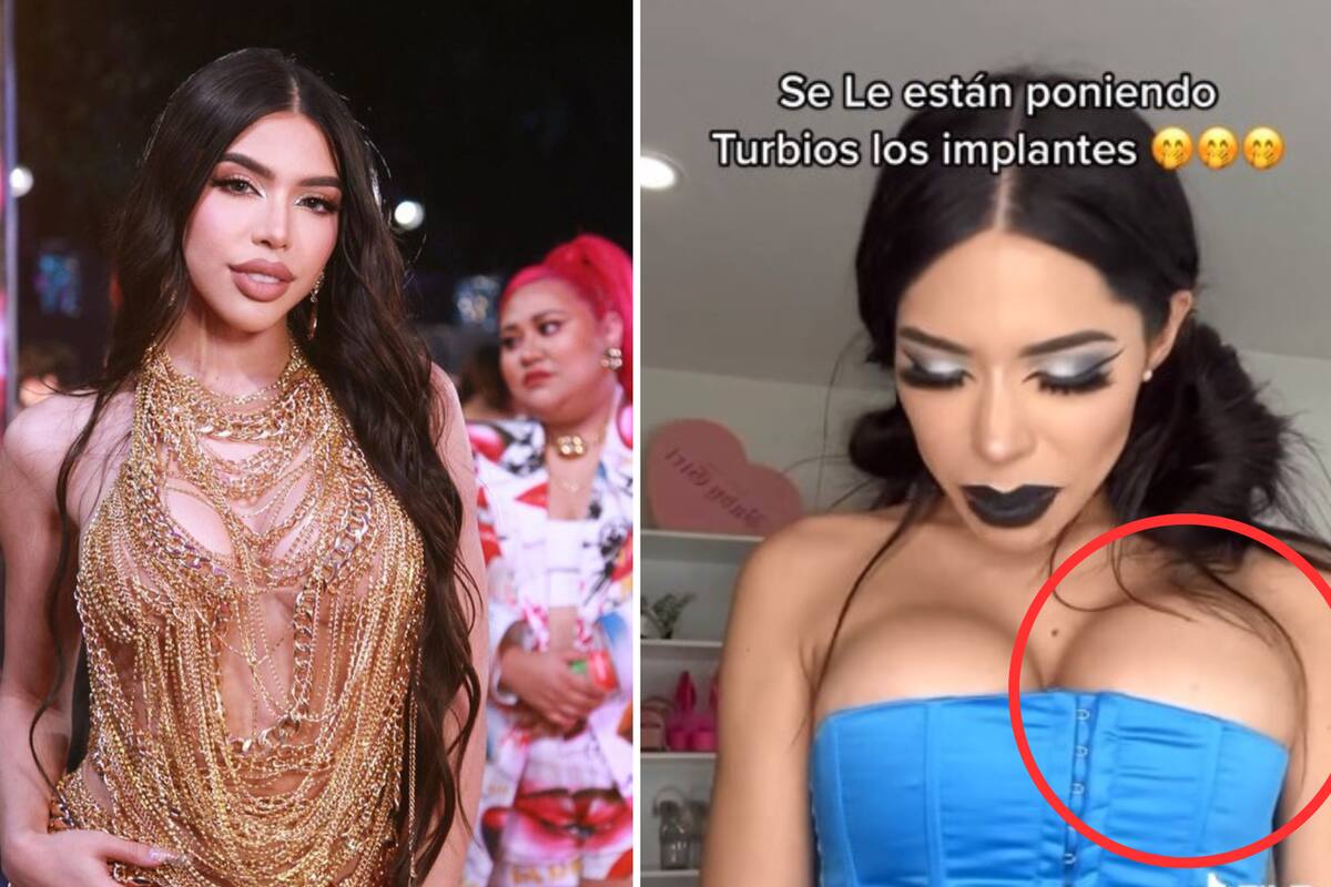 Yeri Mua confiesa que se le volteó un implante de seno; podría entrar a cirugía