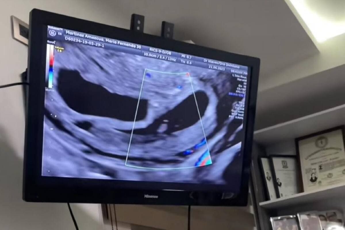 Mujer va al ginecólogo a causa de quistes y descubre que tiene un embarazo múltiple