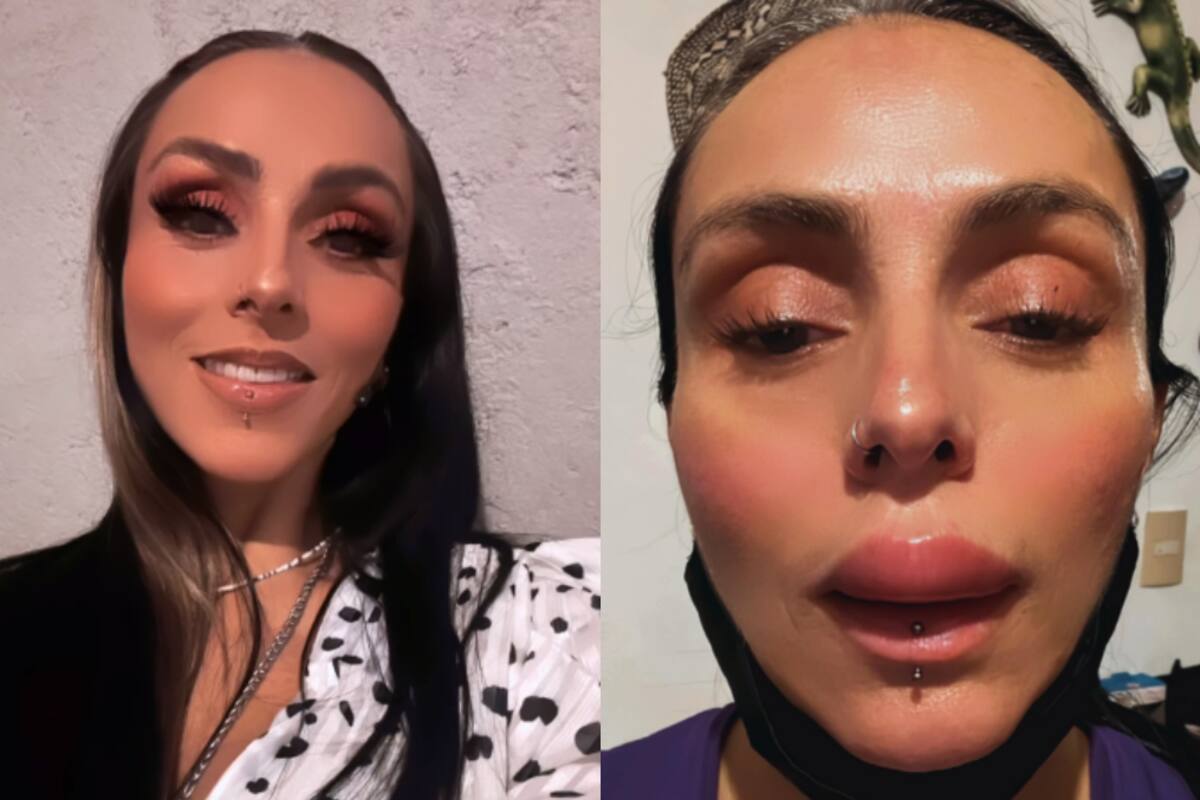 Ivonne Montero alarmó a sus seguidores con esta foto: ¿qué fue lo que le pasó en los labios?