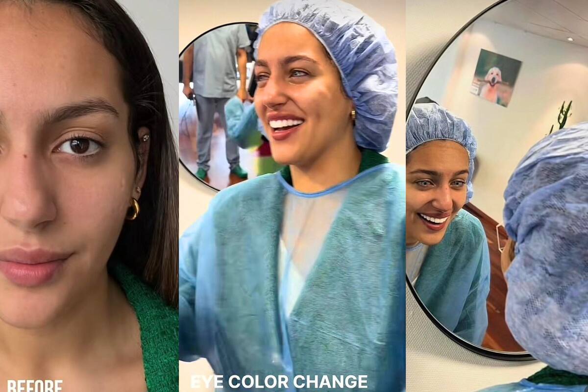 Se viraliza procedimiento para cambiar el color de ojos a pesar de correr el riesgo de generar ceguera