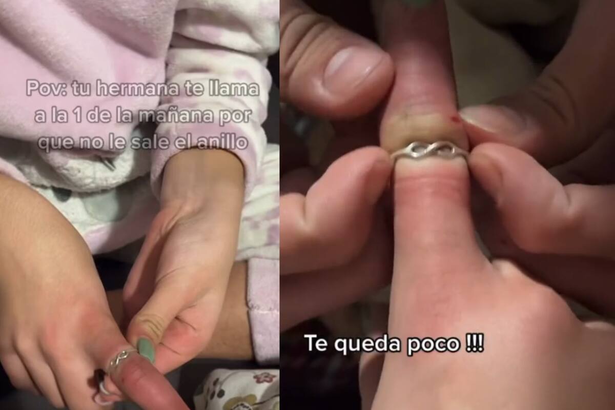 Mujer se le atora el anillo en el dedo y prueba alternativas caseras para solucionarlo