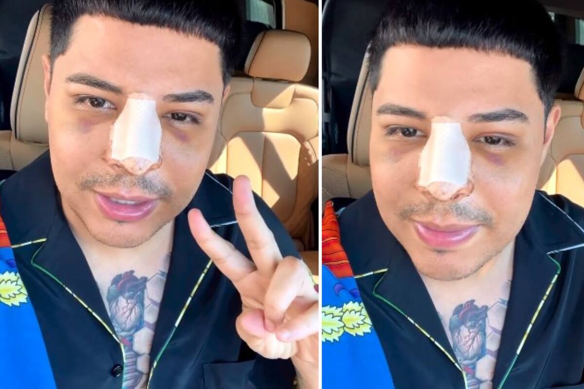 Eduin Caz aparece recién operado y pide comprensión tras posponer concierto