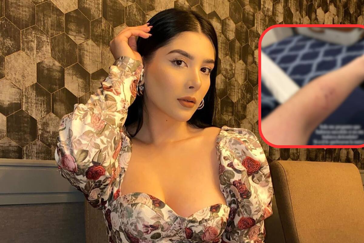 Novia de Luis R Conriquez revela detalles de la agresión que vivió a manos de la exesposa del cantante