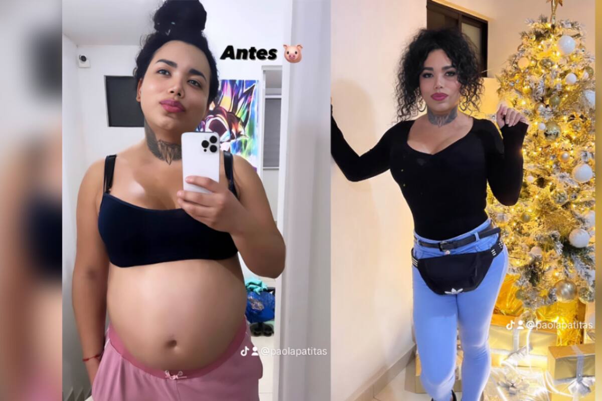 Paola Suárez de "Las Perdidas" comparte su IMPACTANTE cambio físico tras cirugía