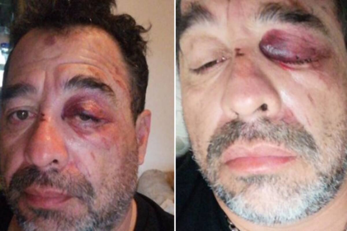 "Me fui de cara a las piedras": Así fue el accidente de "El Borrego" Nava en su moto