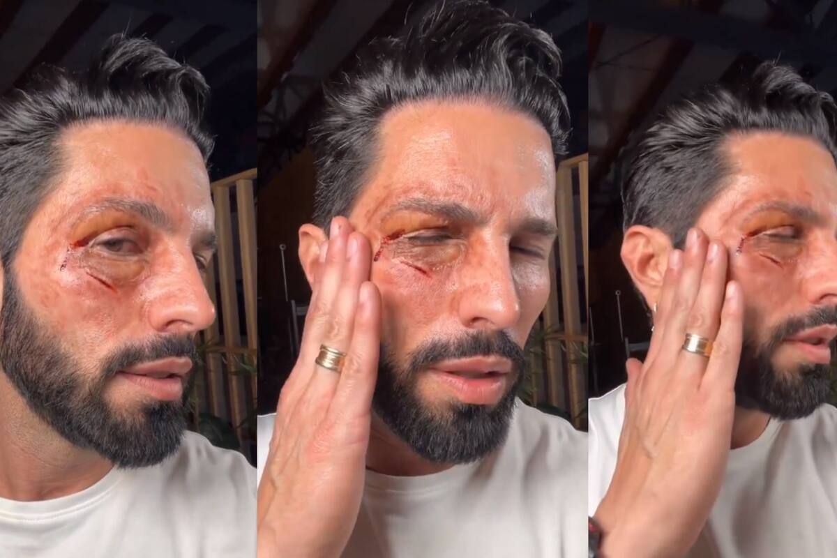 ¿Qué le pasó a Poncho De Nigris? Desata polémica al aparecer "golpeado" en un video que causa revuelo en redes