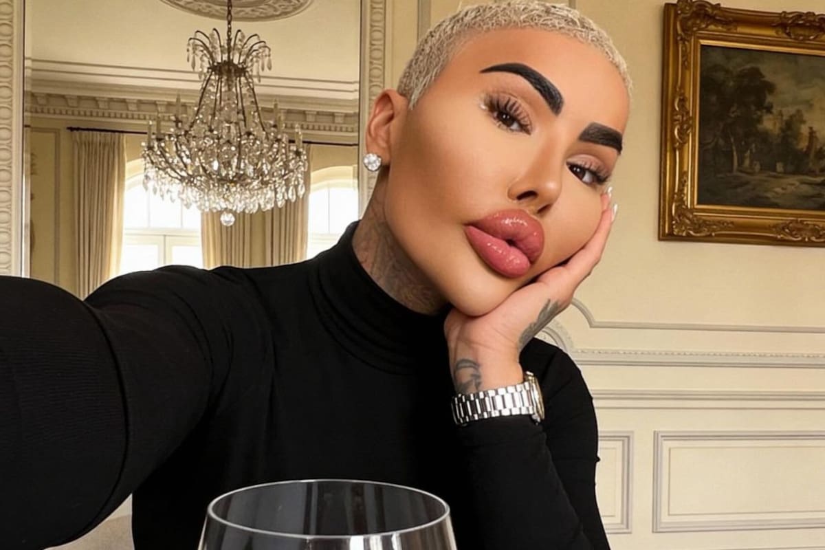 Hallan sin vida a Jordan James Parke, influencer y protagonista de ‘Botched’ en Londres: la Policía Metropolitana califica su muerte como “inexplicable”