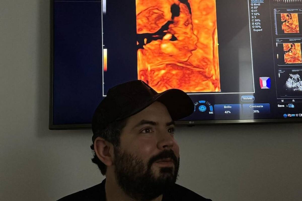 José Eduardo Debrez y Paola Dalay comparten imágenes de su futura hija, Tessa