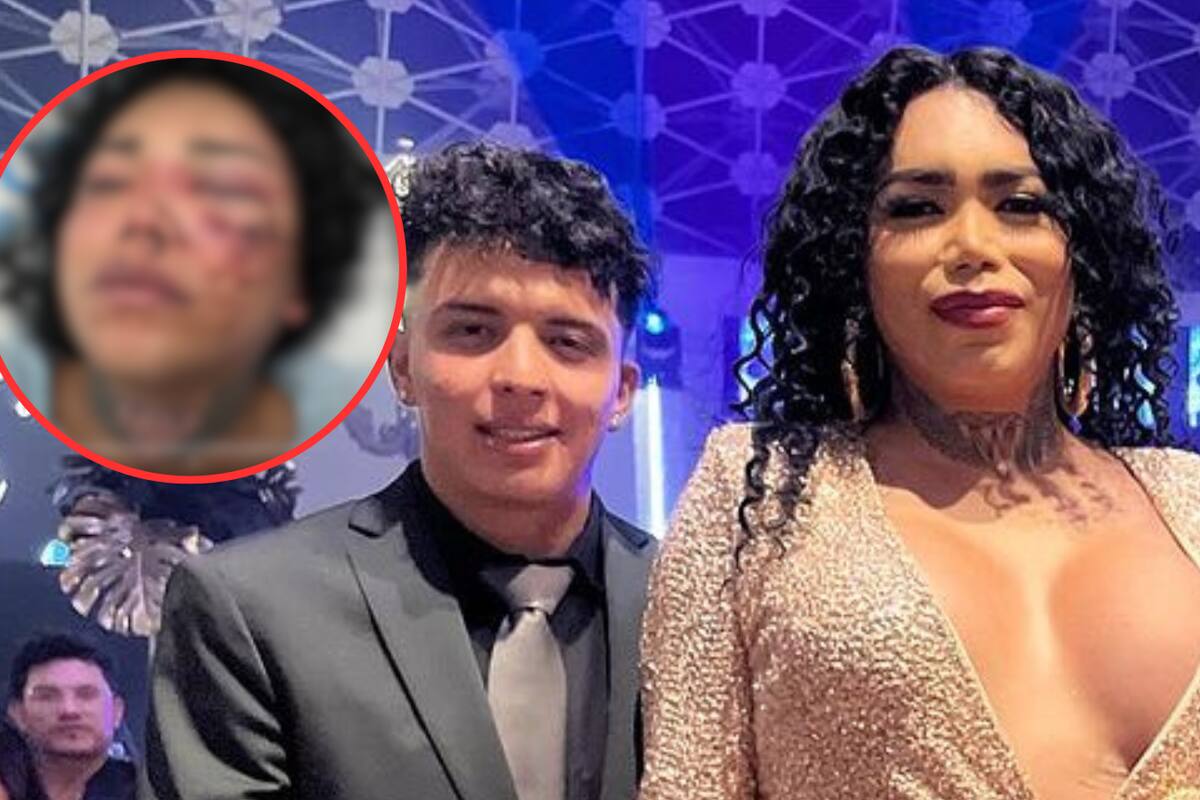 ¿Por qué Paola Suárez fue brutalmente atacada por su prometido?