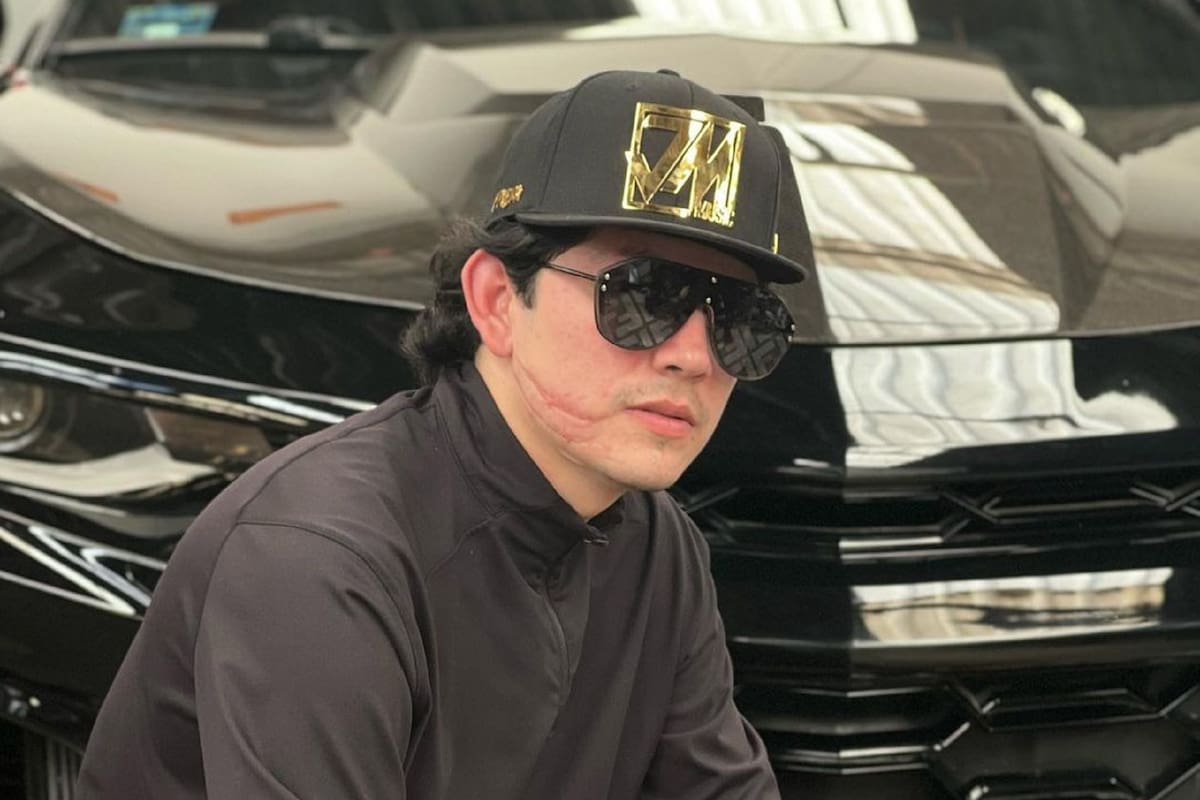 "El Pantera de Culiacán" perdió un ojo en su accidente y estuvo a punto de dejar de cantar