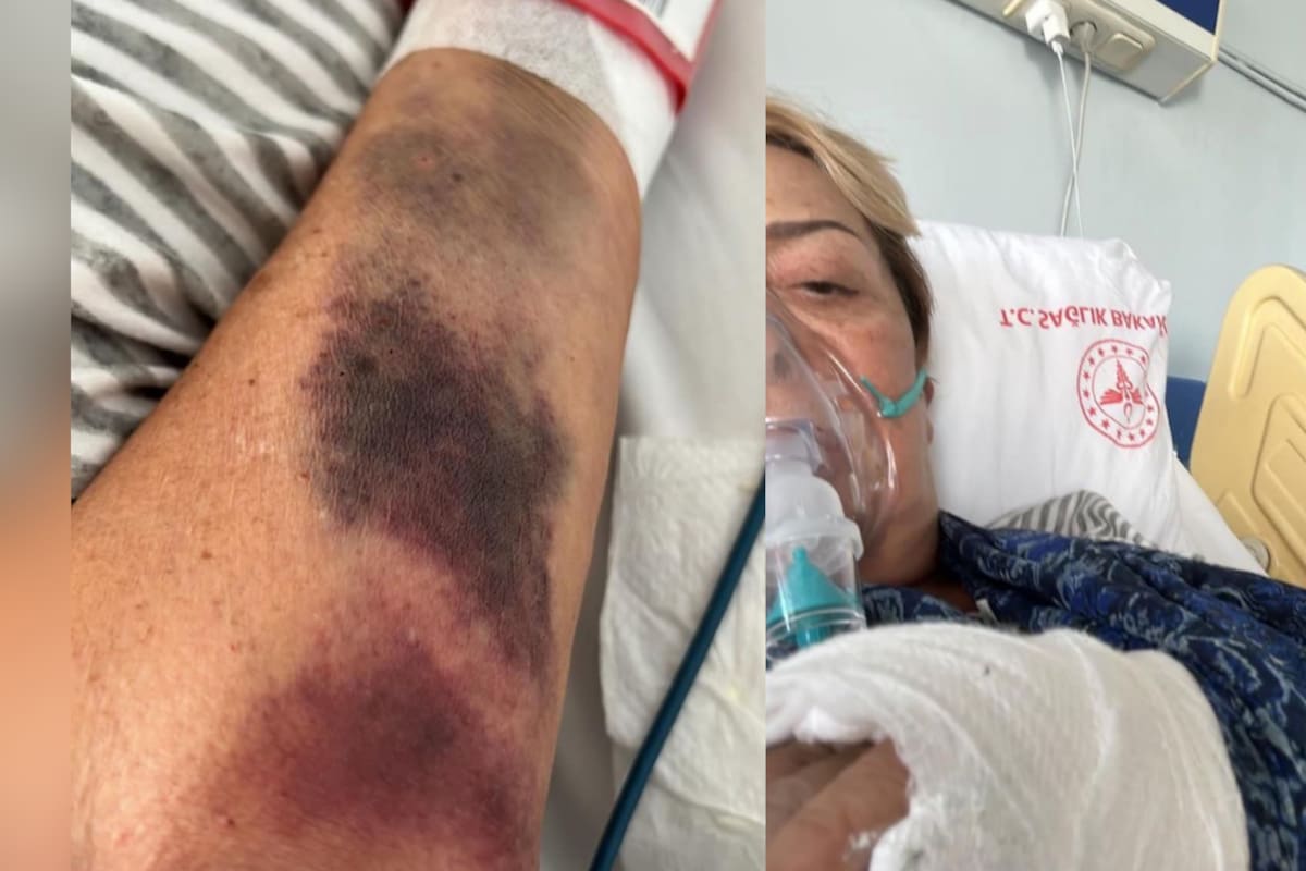 Estas son las primeras imágenes de Sylvia Pasquel tras el GRAVE accidente que tuvo en Europa