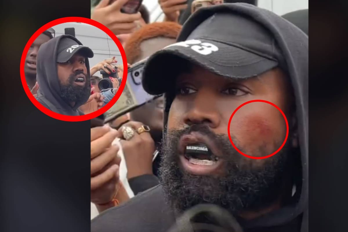 Kanye West reaparece en público, luciendo desorientado, golpeado y contradiciéndose