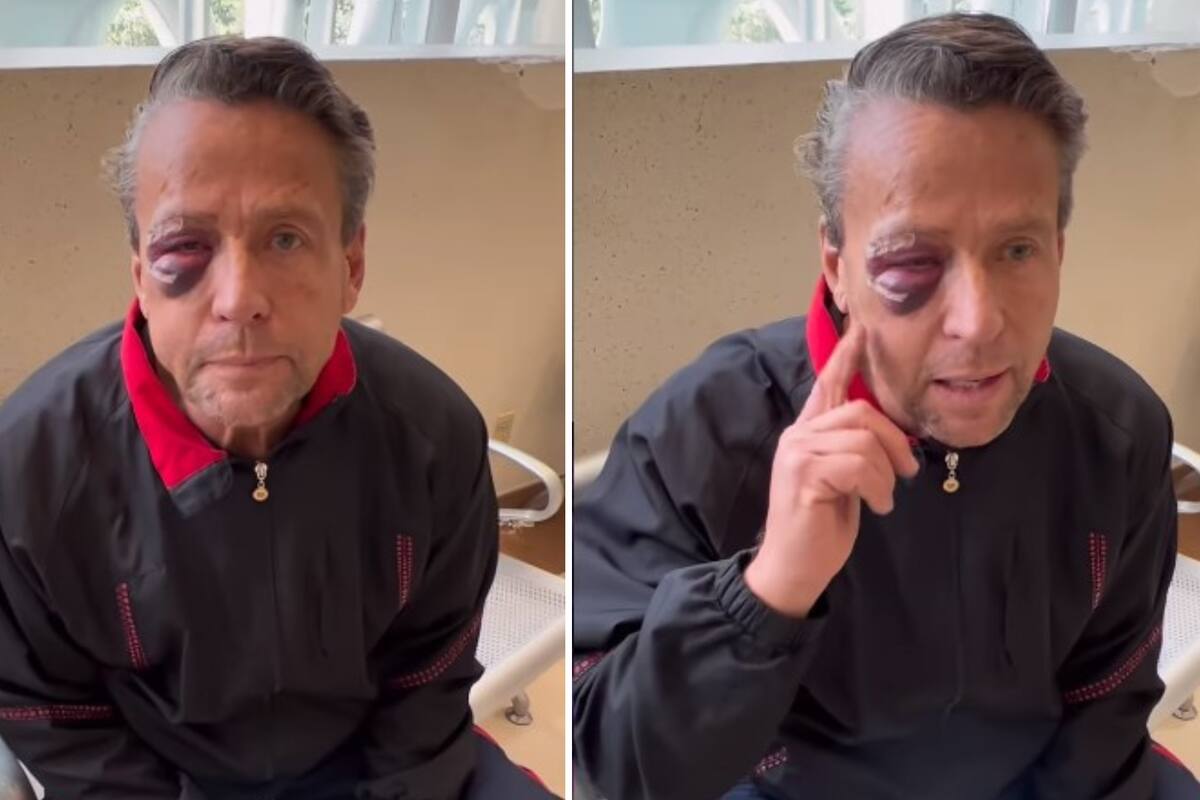 Alfredo Adame resulta con cuatro fracturas faciales y será operado tras golpiza