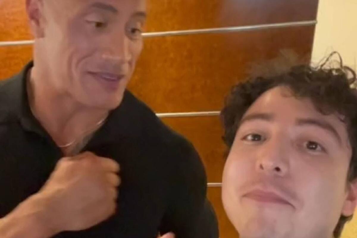 VIDEO VIRAL: Joven comparte el moretón que le hizo "La Roca" tras conocerlo