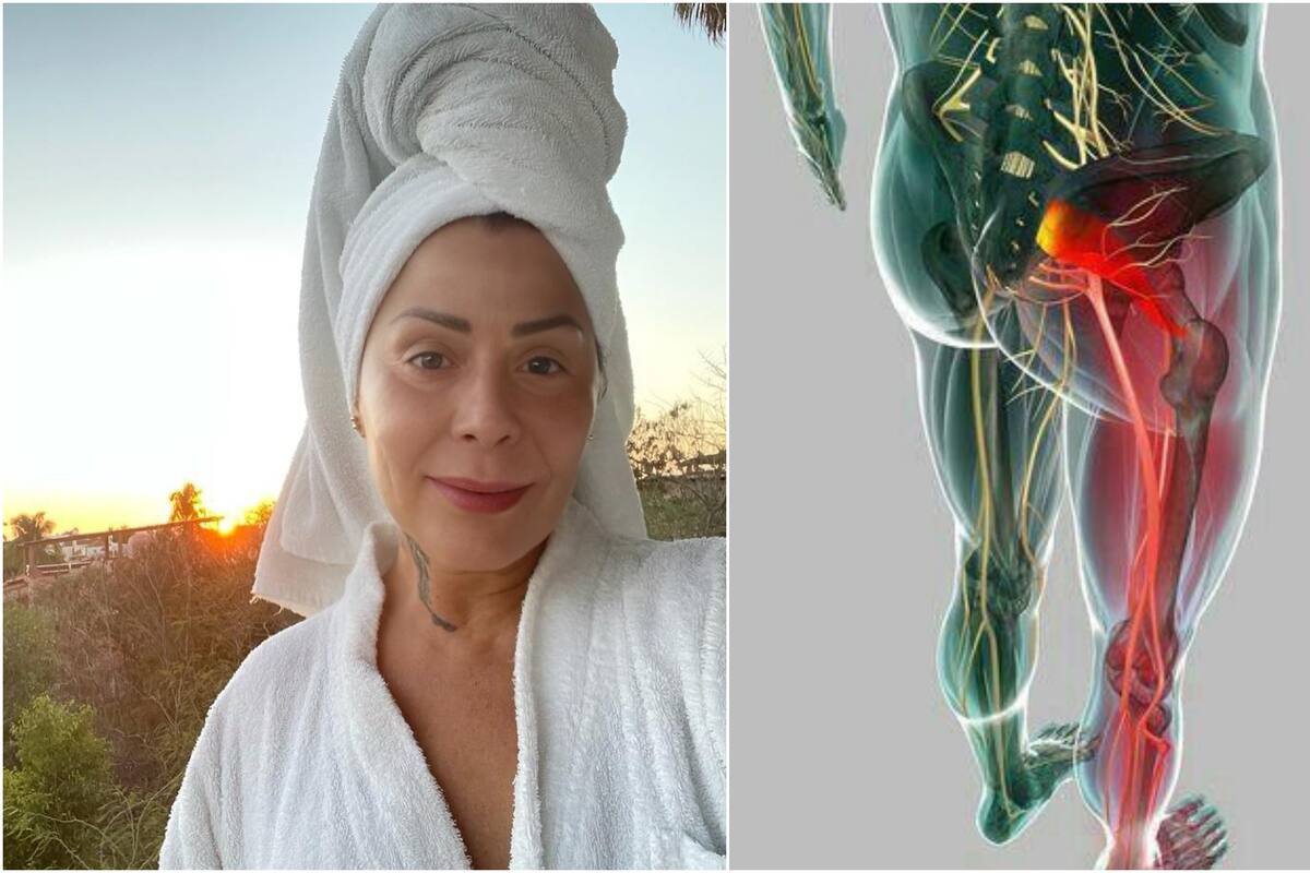 Este es el síndrome que padece Alejandra Guzmán y que la hizo cancelar una presentación